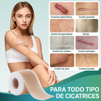 Cinta de silicon para arrugas cicatrices y manchas